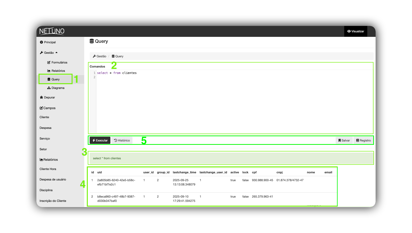 Interfaccia Query